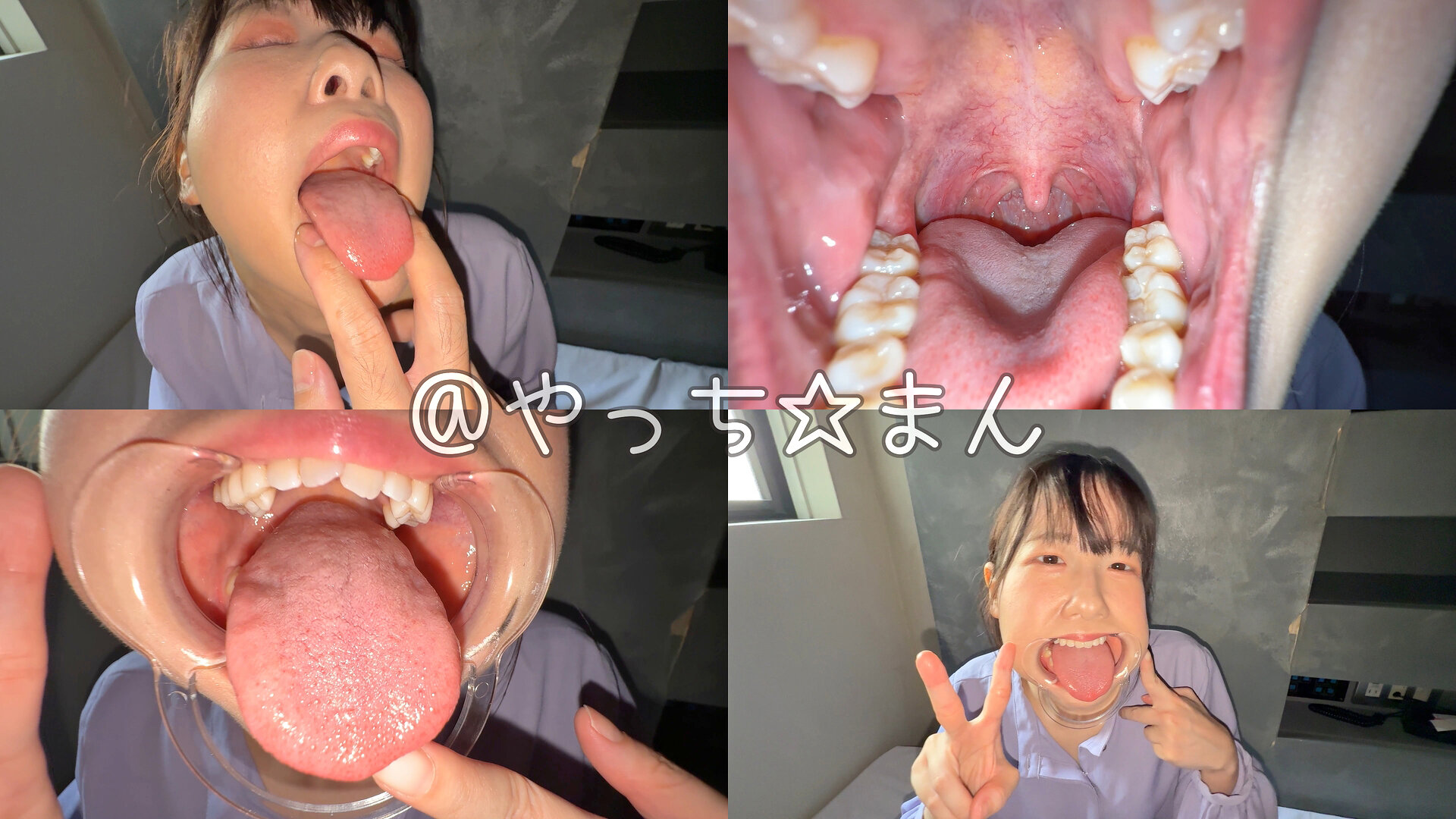 【個人撮影】谷田かりな 開口器で口内観察デカ舌を要チェック
